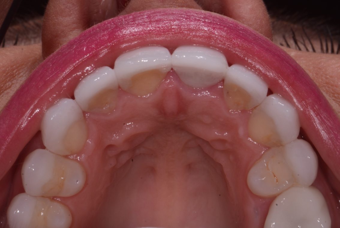 Figure 5. Occlusal view